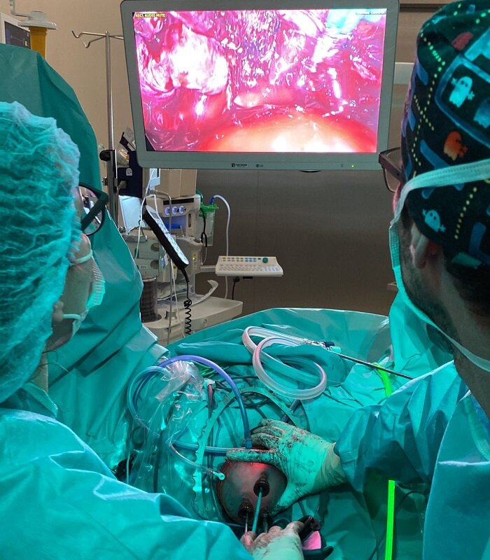 Cirurgia laparoscòpica via vaginal