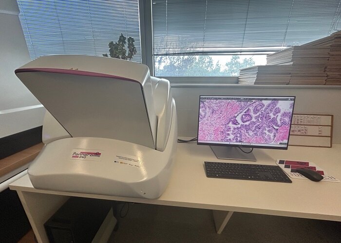 L’Hospital Universitari de Mataró inicia la digitalització del Servei d’Anatomia Patològica per oferir diagnòstics més ràpids i segurs